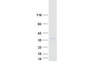 Validation with Western Blot (CH25H Protein (Myc-DYKDDDDK Tag))