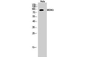 Western Blotting (WB) image for anti-Mdm2, p53 E3 Ubiquitin Protein Ligase Homolog (Mouse) (MDM2) (Ser880) antibody (ABIN3185503) (MDM2 antibody  (Ser880))