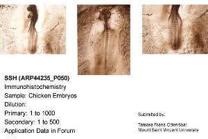 Sample Type: Chicken EmbryosDilution: 1:1000 (Sonic Hedgehog antibody  (N-Term))