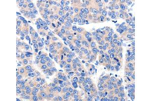 Immunohistochemistry (IHC) image for anti-Potassium Voltage-Gated Channel, Subfamily H (Eag-Related), Member 8 (KCNH8) antibody (ABIN2431491) (KCNH8 antibody)