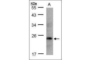 Sample( 30 µg whole cell lysate). (Growth Hormone 1 antibody  (Ser235))