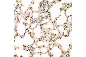 Immunohistochemistry of paraffin-embedded rat lung using SFN antibody at dilution of 1:100 (x400 lens). (14-3-3 sigma/SFN antibody)