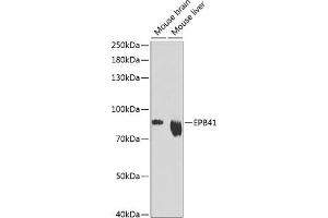 Western blot analysis of extracts of various cell lines, using EPB41 Antibody (ABIN6132258, ABIN6140197, ABIN6140198 and ABIN6216056) at 1:1000 dilution. (EPB41 antibody  (AA 210-500))