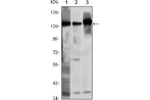 Western blot analysis using SMC1 mouse mAb against K562 (1), Jurkat (2) and A549 (3) cell lysate. (SMC1A antibody)