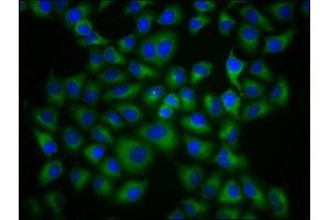 Immunofluorescence staining of Hela cells with ABIN7155551 at 1:133, counter-stained with DAPI. (HLAG antibody  (AA 25-337))