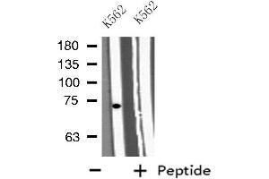 Western blot analysis of extracts from K562 cells, using GAB2 antibody. (GAB2 antibody  (C-Term))