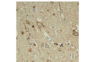 Immunohistochemistry of paraffin-embedded Rat hippocampal region tissue from a model with Alzheimer, using Phospho-Tau(S396) Polyclonal Antibody (tau antibody  (pSer396))