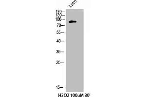Western Blot analysis of LOVO+H2O2 cells using Phospho-Cortactin (Y421) Polyclonal Antibody (Cortactin antibody  (pTyr421))