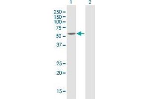 Western Blot analysis of HNF4A expression in transfected 293T cell line by HNF4A MaxPab polyclonal antibody. (HNF4A antibody  (AA 1-464))