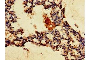 Immunohistochemistry of paraffin-embedded human lung tissue using ABIN7153347 at dilution of 1:100 (GPR4 antibody  (AA 285-362))