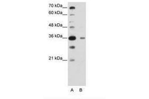 Image no. 2 for anti-DAZ Associated Protein 1 (DAZAP1) (C-Term) antibody (ABIN6736222) (DAZAP1 antibody  (C-Term))
