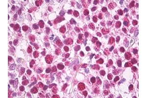 Anti-MCM5 antibody IHC of human tonsil.