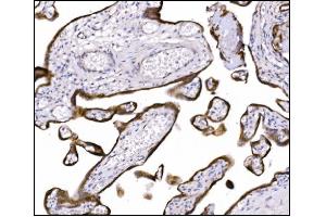 IHC analysis of NDEL1 using anti-NDEL1 antibody (ABIN7602511).