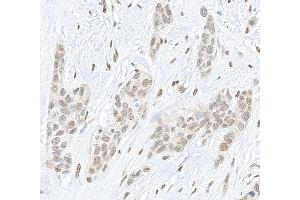 anti-Proprotein Convertase Subtilisin/kexin Type 2 (PCSK2) (AA 150-200) antibody