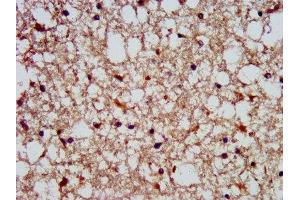 IHC image of ABIN7169777 diluted at 1:300 and staining in paraffin-embedded human brain tissue performed on a Leica BondTM system. (SLAIN1 antibody  (AA 43-136))