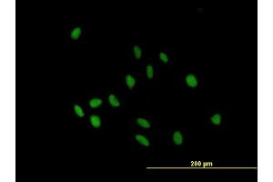 Immunofluorescence of purified MaxPab antibody to IGHA2 on HeLa cell. (IGHA2 antibody  (AA 1-477))