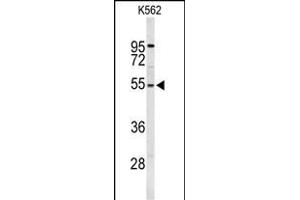 Western blot analysis of RPS6KB2 Antibody (ABIN652424 and ABIN2842096) in K562 cell line lysates (35 μg/lane).