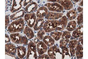 Immunohistochemical staining of paraffin-embedded Human Kidney tissue using anti-MYD88 mouse monoclonal antibody. (MYD88 antibody)