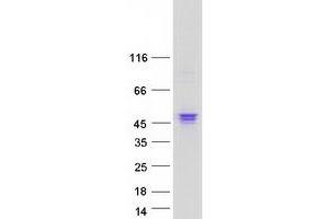 Western Blotting (WB) image for Fibroblast Growth Factor Receptor 1 (FGFR1) (Transcript Variant 5) protein (Myc-DYKDDDDK Tag) (ABIN2721163)