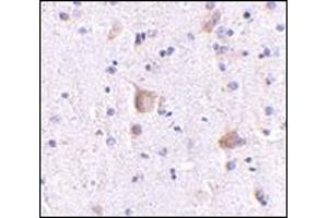 Immunohistochemistry of Rim2 in human brain with this product at 5 μg/ml.