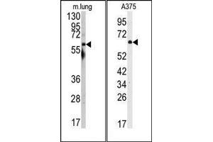 Image no. 1 for anti-Nuclear Receptor Coactivator 1 (NCOA1) (N-Term) antibody (ABIN359992) (NCOA1 antibody  (N-Term))