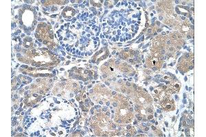 Immunohistochemistry (IHC) image for anti-Sarcosine Dehydrogenase (SARDH) (Middle Region) antibody (ABIN2775361) (SARDH antibody  (Middle Region))