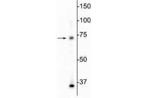 Western blot of mouse whole brain lysate showing specific immunolabeling of the MeCP2 protein at ~75 kDa. (MECP2 antibody)