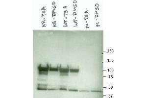 Image no. 1 for anti-Heat Shock Protein 90kDa alpha (Cytosolic), Class A Member 1 (HSP90AA1) (AA 289-300) antibody (ABIN401342) (HSP90AA1 antibody  (AA 289-300))