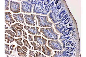 NARG1 was detected in paraffin-embedded sections of mouse intestine tissues using rabbit anti- NARG1 Antigen Affinity purified polyclonal antibody (Catalog # ) at 1 µg/mL. (NAA15 antibody  (N-Term))