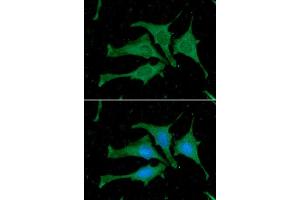 ICC/IF analysis of Calmodulin in HeLa cells. (Calmodulin 1 antibody)