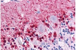 Human Brain, Cerebellum: Formalin-Fixed, Paraffin-Embedded (FFPE) (KLF2 antibody  (AA 216-265))