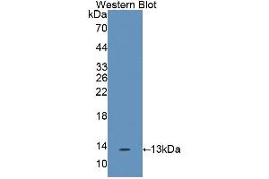 Western blot analysis of the recombinant protein. (IL17F antibody  (AA 31-163))