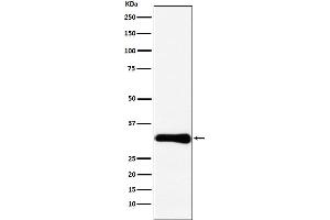 Western blot analysis of Bcl10 expression in HeLa cell lysate. (Recombinant BCL10 antibody)