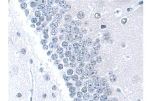 Immunohistochemistry (IHC) image for anti-WW and C2 Domain Containing 1 (WWC1) (AA 847-1094) antibody (ABIN7441667)