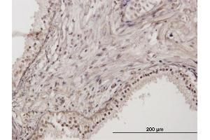 Immunoperoxidase of purified MaxPab antibody to RNF111 on formalin-fixed paraffin-embedded human prostate. (RNF111 antibody  (AA 1-985))