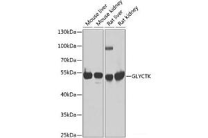 Western blot analysis of extracts of various cell lines using GLYCTK Polyclonal Antibody at dilution of 1:1000. (GLYCTK antibody)
