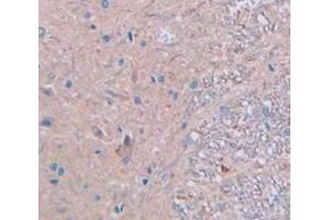 IHC-P analysis of Rat Tissue, with DAB staining. (CKM antibody  (AA 11-367))