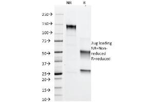 SDS-PAGE Analysis Purified Adipophilin Mouse Monoclonal Antibody (ADFP/1366). (ADRP antibody  (AA 249-376))