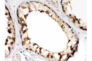 TCP1 beta was detected in paraffin-embedded sections of human testis tissues using rabbit anti- TCP1 beta Antigen Affinity purified polyclonal antibody (Catalog # ) at 1 µg/mL. (CCT2 antibody  (AA 414-535))