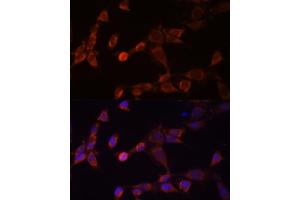 Immunofluorescence analysis of NIH-3T3 cells using PSMD14 Polyclonal Antibody (ABIN6131927, ABIN6146340, ABIN6146341 and ABIN6214977) at dilution of 1:100 (40x lens). (PSMD14 antibody  (AA 160-300))