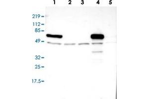 Western blot analysis of Lane 1: RT-4, Lane 2: U-251 MG, Lane 3: A-431, Lane 4: Liver, Lane 5: Tonsil with MAOB polyclonal antibody (PAB28552). (Monoamine Oxidase B antibody)