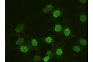 Anti-ACTN1 mouse monoclonal antibody (ABIN2452359) immunofluorescent staining of HeLa cells transiently transfected by pCMV6-ENTRY ACTN1 (RC204924) (ACTN1 antibody  (AA 650-893))