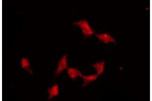 ABIN6274155 staining Hela by IF/ICC. (ADRA2A antibody  (Internal Region))
