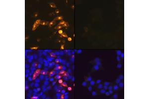 Immunofluorescence analysis of SARS-CoV-2 Nucleoprotein transfect Hela cells using SARS-CoV-2 Nucleoprotein pAb(ABIN7269053). (SARS-CoV-2 Envelope antibody)