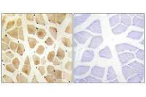 Immunohistochemistry analysis of paraffin-embedded human skeletal muscle tissue using SLK antibody. (SLK antibody  (C-Term))