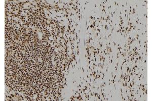 ABIN6277616 at 1/100 staining Human gastric tissue by IHC-P. (UROD antibody  (C-Term))