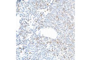 Immunohistochemistry (IHC) image for anti-Interleukin 7 Receptor (IL7R) (AA 21-236) antibody (ABIN7453897) (Recombinant IL7R antibody  (AA 21-236))