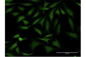 Immunofluorescence of monoclonal antibody to SSH1 on HeLa cell. (SSH1 antibody  (AA 950-1049))
