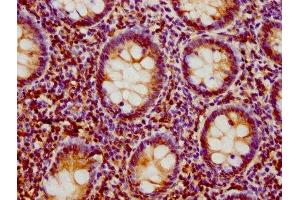 IHC image of ABIN7157950 diluted at 1:500 and staining in paraffin-embedded human appendix tissue performed on a Leica BondTM system. (LIME antibody  (AA 170-295))