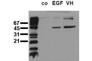 Western Blotting (WB) image for anti-Mitogen-Activated Protein Kinase Kinase 1 (MAP2K1) (pSer218), (pSer222), (pSer226) antibody (ABIN126836) (MEK1 antibody  (pSer218, pSer222, pSer226))
